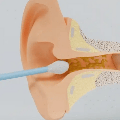 EcloPure® – Nettoyage intelligent des oreilles avec technologie avancée